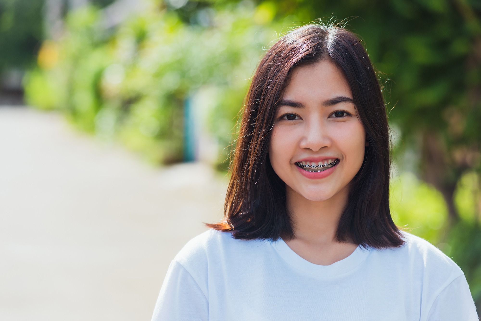 invisalign liberty township