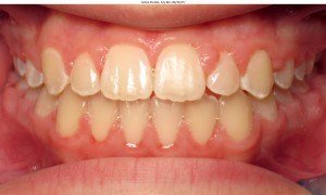 west chester orthodontics