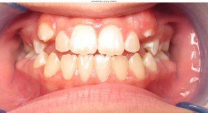 west chester orthodontics