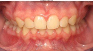 west chester orthodontics