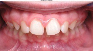 west chester orthodontics