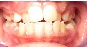 west chester orthodontics