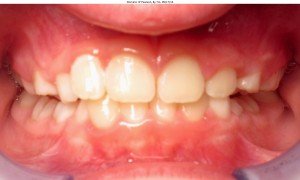 west chester orthodontics