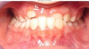 west chester orthodontics