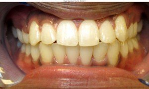 west chester orthodontics