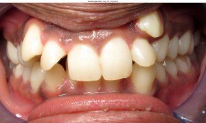 west chester orthodontics