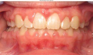 west chester orthodontics