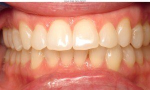 west chester orthodontics