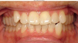 west chester orthodontics