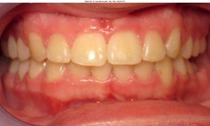west chester orthodontics