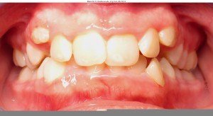 west chester orthodontics