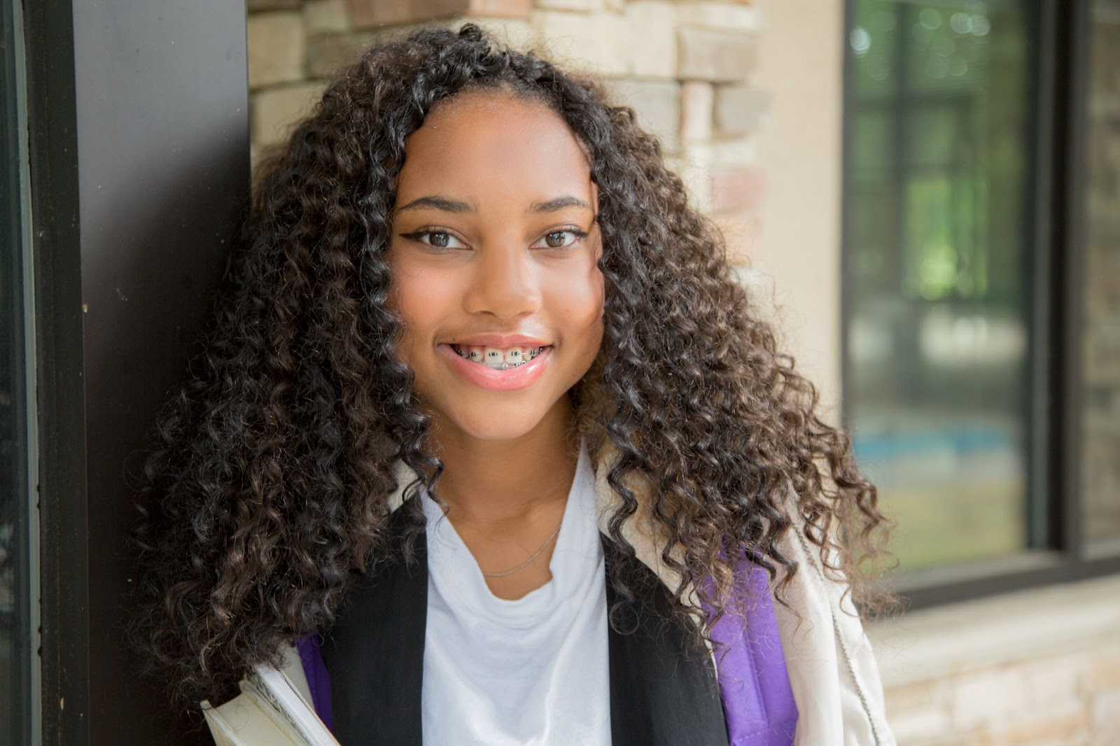 How to Care for Your Braces In Between Appointments