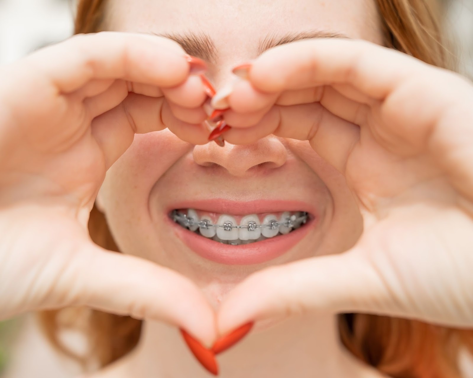 5 Tips for Braces and Invisalign